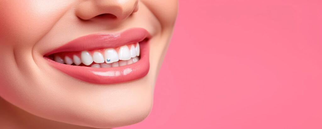 Enhance Your Smile with Dental Jewellery: A Stylish Option